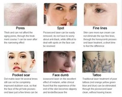 4 in 1 IPL Elight Diode Laser Hair Removal
