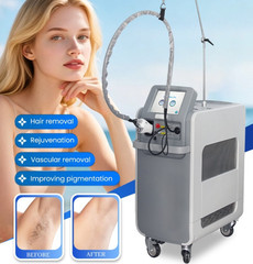 755/1064nm Alexandrite Long-Pulse Fiber Semiconductor Laser Hair Removal Machine