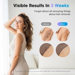 IPL Laser Hair Removal Device for Women & Men – Home 45°F Ice-Cooling Yellow