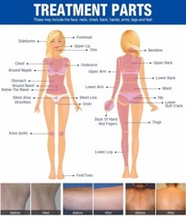 808nm Diode Laser Hair Removal 808 1064 755nm Painless Permanent Epilator