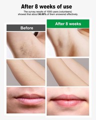 IPL Hair Removal Device, model: AI06, for Facial 1 Count (Pack of 1), Green