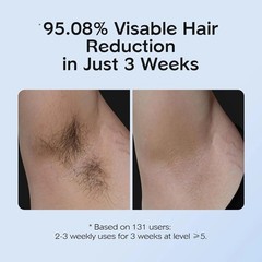IPL Hair Removal with Ice Cooling Care Function for Women,Long-Lasting Result…