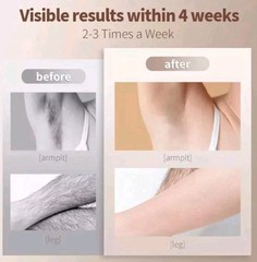 IPL Hair Removal Device 5 Energy Levels Men Women Facial Legs Arms Bikini Line