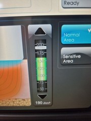 Used Syneron Candela eTwo Fractional RF Laser – Acne Scars, Wrinkles 💯 Working