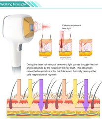 1064/755/808nm Diode Laser Permanent Body Facial Hair Removal Beauty Machine SPA