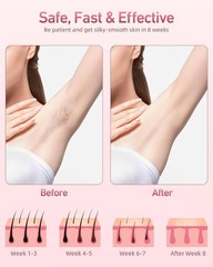 5 Energy Levels IPL Hair Removal Device – 86% Reduction, At-Home Safety Solution