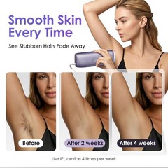 IPL Hair Removal Device 25J Sapphire Ice Cooling Painless Full Body Skin Sensor