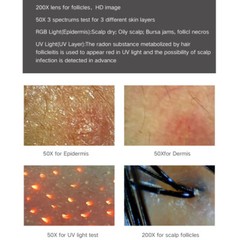 Smart HD Hair Follicle &Facial Skin Detector Pro Skin Hair Scalp Analyze Machine