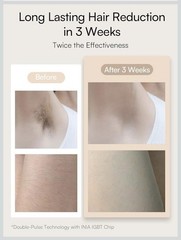 INIA HAUT Pro IPL Hair Removal Device – Women & Men, Ice Cooling, 5 Flashes/sec