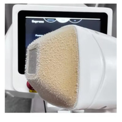 Professional 2026 ICE Titanium 755/808/1064nm Diode Laser Hair Removal Machine