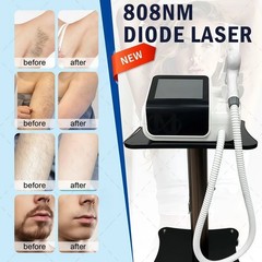 Portable household diode laser hair removal machine 755/808/940/1064nm