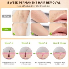 Home IPL Laser Hair Removal Device – Body, Bikini, Armpit, Face