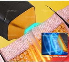 Professional 2026 ICE Titanium 755/808/1064 Diode Laser Hair Removal System