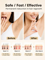 IPL Laser Hair Removal Device 999999 Flashes for Women & Men Face Body