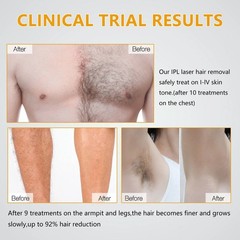 IPL Laser Hair Removal Machine 990000 Flashes Permanent Epilator for Face & Body