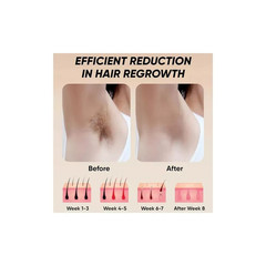 XSoul IPL Hair Removal Device 999,999 Flashes (New Open Box) FAST FREE SHIPPING.