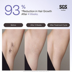 Ulike Air 4 Purple IPL Laser Hair Removal Device Ice-Cool Permanent Reduction