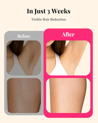 990000 Flashes IPL Hair Removal Painless Permanent For Body Face & Bikini -WHITE