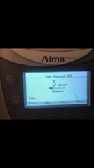Alma Laser