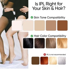 Sensica IPL Hair Removal Device – IPL030 Sensilight MINI, At-Home Plug-In for…