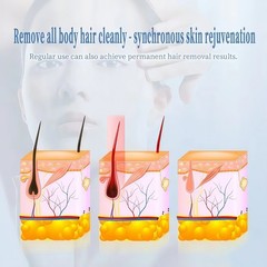 Portable household diode laser hair removal machine 755/808/940/1064nm