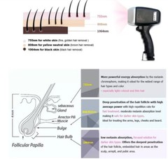 3000W Diode Laser 755 808 1064nm Hair Removal Laser Machine 12 bar Beauty SPA