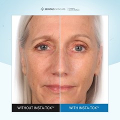 Serious Skincare INSTA-TOX Instant Wrinkle Smoothing 0.75 Fl Oz (Pack of 2)
