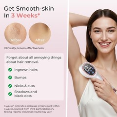IPL Laser Hair Removal Device – 21J Energy, 96% Reduction, Safe for Face & Body