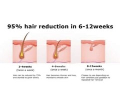 MiSMON IPL Laser Hair Removal Permanent Painless 3-in-1 Skin Care Beauty Device