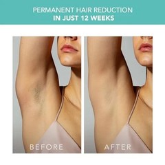 FOREO PEACH™ 2 Go IPL Hair Removal Device – Mint Green – Travel Version – NEW Op