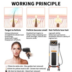 Painless Diode Laser Hair Removal 1064 755 810nm Machine Skin Rejuvenation