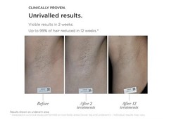 SmoothSkin Pure Fit IPL Hair Remover At Home Laser Hair Reduction Device