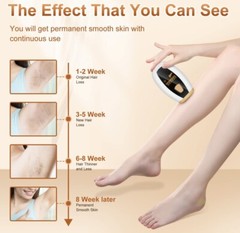 MYWIN Laser Hair Removal,Laser Hair Removal For Women Permanent,Ipl Hair Remova