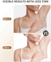 IPL At-Home Hair Removal Device for Women And Men, Laser Permanent New/Sealed