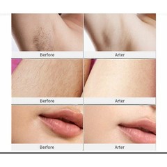 IPL Hair Removal Device for Women Men Whole Body Corded 999900 Flashes NEW