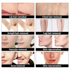IPL OPT Permanet Laser Hair Removal Machine RF Pigment Therapy Skin Rejuvenation