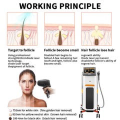 810 Diode Laser Hair Removal Machine With 3Wavelength 755 1064 810nm Diode Laser