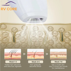 IPL Laser Hair Removal Device — 900K Flashes, 5 Levels, Painless Body & Bikini