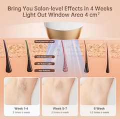 IPL Hair Removal Device