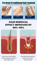 Portable household diode laser hair removal machine 755/808/940/1064nm