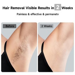 Painless Laser Hair Removal Device with Ice-Cooling, 3-in-1 Skin Rejuvenation, 8