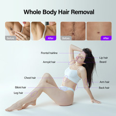 4-in-1 Diode Laser Pico IPL RF Hair Removal Skin Rejuvenation Tattoo Removal