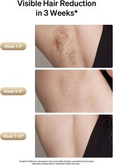 Ulike Laser Hair Removal, Air 3 IPL Hair Removal with Gift Set, Sapphire Ice-Co
