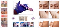 IPL Hair Removal Toning Scar Wrinkle Spider Vein Treatment System {With Kit}.