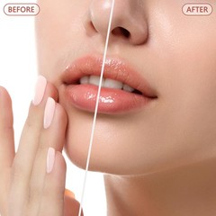 EVIEY Facial Hair Remover for Women – Painless Electric Face Shaver w/ LED