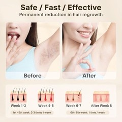 IPL Hair Removal Device LCD Display Adjustable Speeds Auto Mode Sunglasses