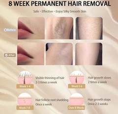 Laser Hair Removal with Ice Cooling for Women and Men 999,999 Flashes IPL…