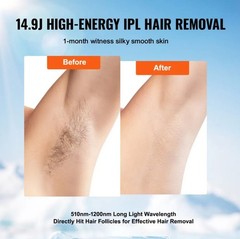 VEVOR Pulsed Light (IPL) System Professional Hair Removal Device T002BW – Gold