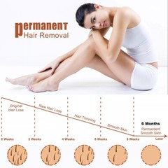 2024 Diode Laser 755nm 810nm 1064nm HAIR REMOVAL Body Skin Whitening Machine