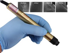 Advanced Permanent Hair Removal System & Kit, Best Salon & Home Use Machine *